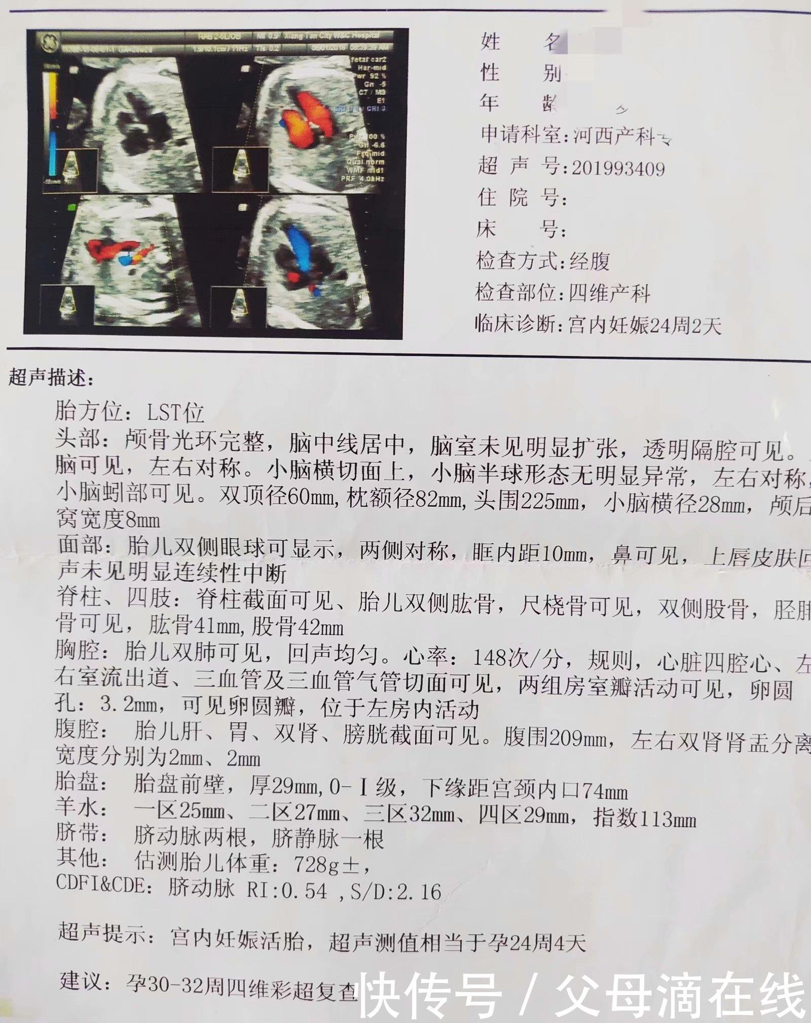 胎动|孕期大排畸检查，快速通过及注意事项，你想知道的都在这里