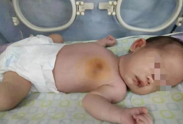 宝宝|宝宝哭闹不止,妈妈掀开衣服后瞬间爆炸:原来是奶奶做了“手脚”