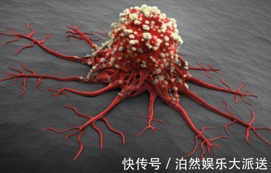 癌细胞|常吃大蒜能够抗癌此物能力远远超过大蒜,每家每户都不缺