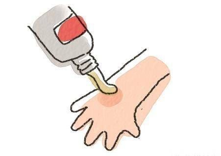 水泡|孩子烫伤后,最佳治疗时间只有2分钟,你知道该怎么做吗?建议收藏