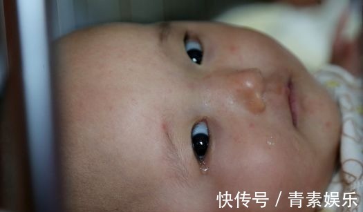 月子期|没磕碰,没摔伤,纯母乳宝宝脑出血,和新妈妈月子期的陋习有关