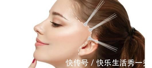 拉皮手术 王小民教授小拉皮手术切口在哪里,会留疤吗!