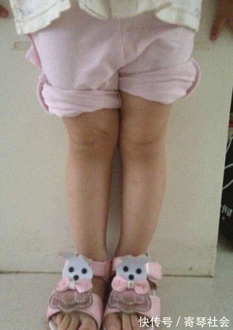 腿部|孩子腿部有这3个特征,长大多半是“大长腿”