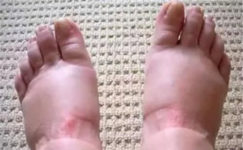 幺蛾子|孕晚期多难熬?看看这些“幺蛾子”就知道了,生娃不易心疼孕妈