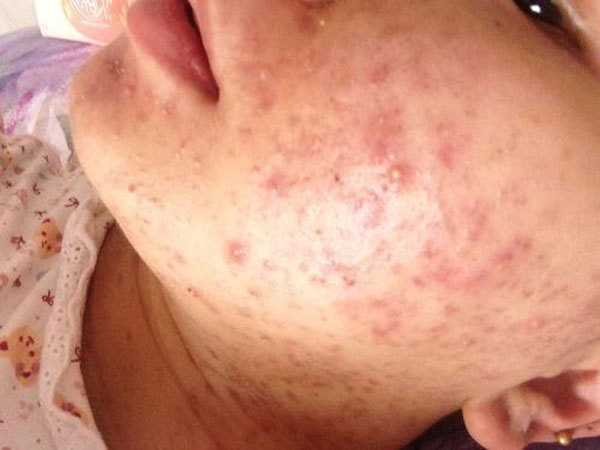 孕吐|老人说孕妈几个表现,很可能怀的是“军大衣”,是真的吗