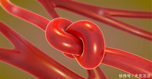 血液|男人最怕的就是“软”?其实这4处越“软”越好,赶紧对照一下