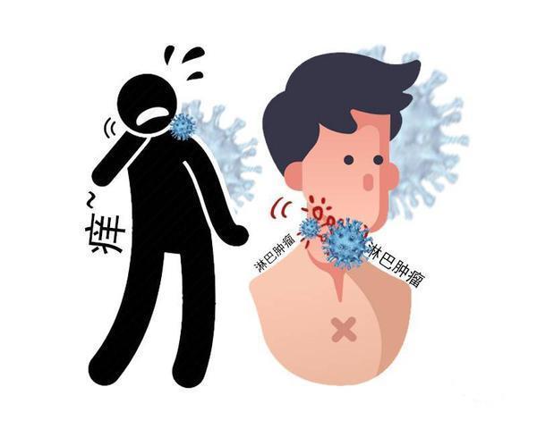 治疗|艾滋病进入新治疗时代?面对艾滋病,早期这5个现象务必要留点心