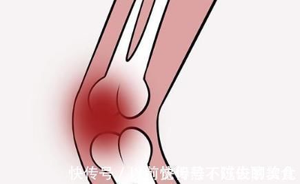 损伤|膝关节损伤，90%都是因为“它”，如今大多数人仍在犯！