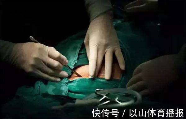 麻药|剖腹产有那么吓人吗?剖腹产步骤和注意事项,提前看看做好准备吧