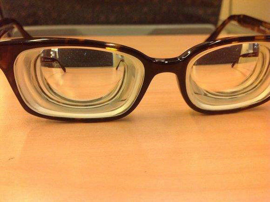 治愈|近视,无法治愈,只能预防