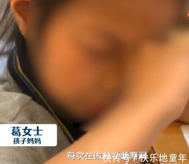 数学|小姑娘一做数学就眼睛过敏,眼睛肿到睁不开