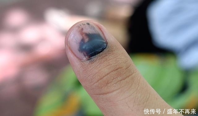 表现|肝好的人,手上可能没有3个“表现”,有一个不占,肝也还可以