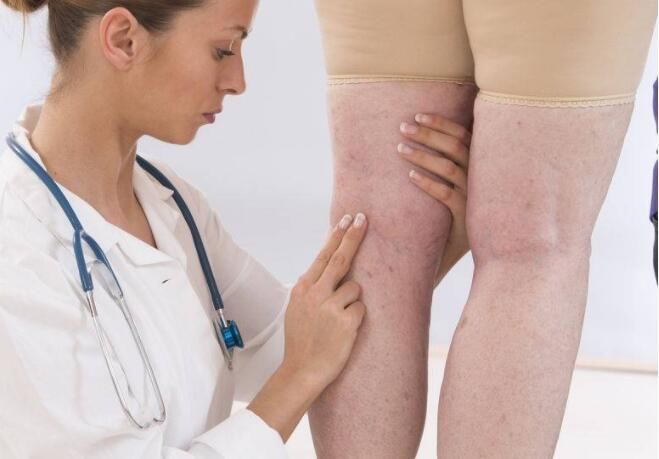 发展期|近期腿部反复有以下三个症状，这就可能是癌变的信号