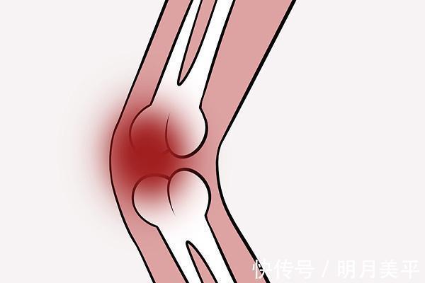 女性|女性步入更年期后，哪些疾病会来“敲门”若全没有，离长寿很近