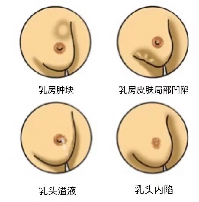 姐妹们|小姐妹们，赶紧来测一测你患乳腺癌的风险！