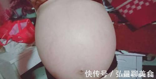 胎停育|孕期人机不离身,准妈妈对辐射不以为然,胚胎被诊断畸形