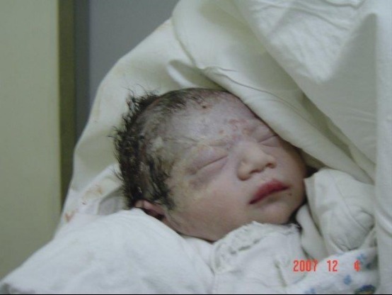 网红|“丑哭宝妈”的网红宝宝巨大变化,当初嫌我丑,如今美到认不出