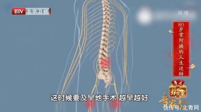 锻炼|人老先老“背”一定不能忽视锻炼后背的肌肉