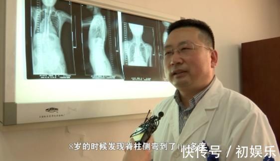 一肩|8岁男孩脊椎侧弯,只因家人常做这个动作,这个错误,90%的父母都在犯