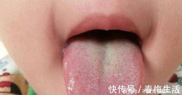 上门|宝宝身上几个信号,多半是由于积食上门了,别傻傻都不知道!