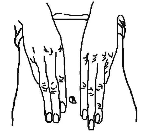 气化酶|老是便秘、排便难该怎么办或许这篇文章能帮你