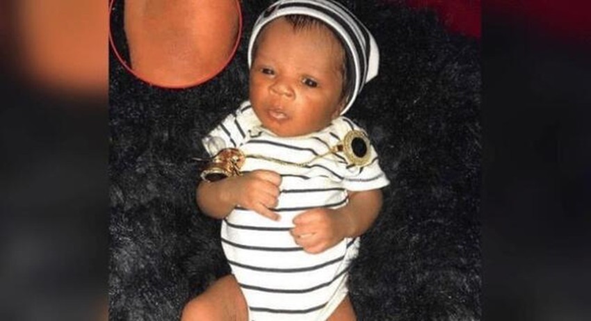 孕妈|姐姐在腹中被弟弟“吸收”,变成胎记留弟弟腿上,网友最美胎记