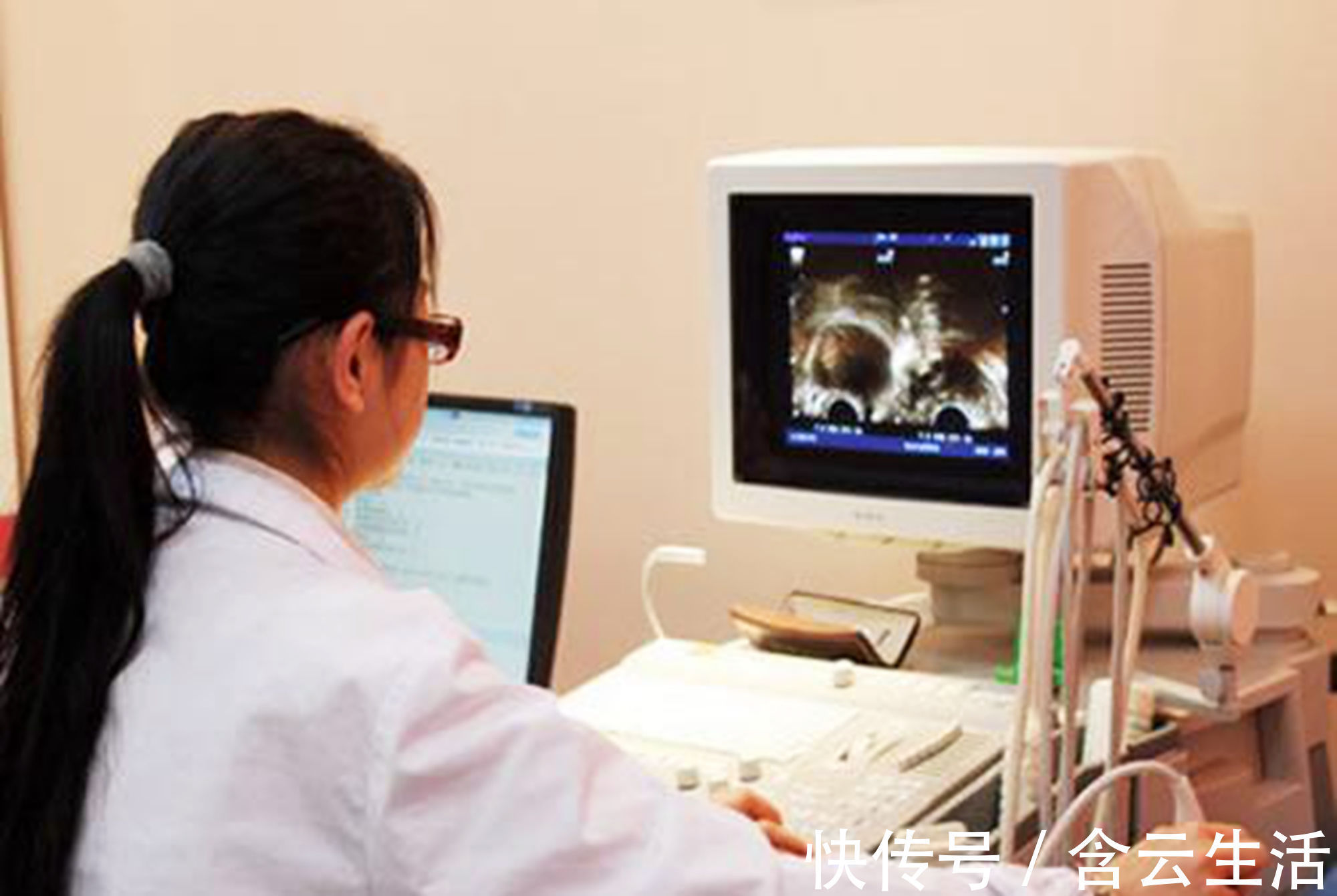 胎盘|孕早期B超单上的四个指标,暗含了胎儿的“小秘密”,你看得懂吗