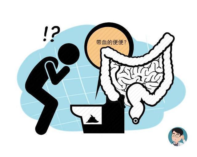 每天排便多,肠癌风险高?一份50万人的研究,或能得到答案
