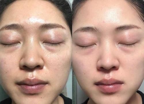 肤色|长期化妆有什么危害?看“妆龄”10年的皮肤有啥问题,尤其第二个