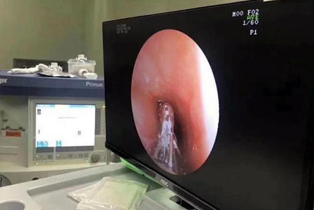 软糖|父母眼中的“健康零食”,制作环境堪比垃圾场,父母至今蒙在鼓里