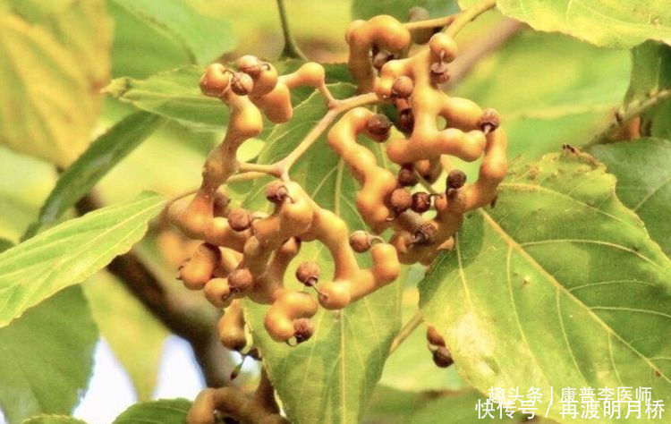 男女想长寿，坚持吃几种食物，助消化，抗衰老，润肠道，谁吃谁好