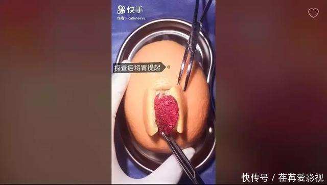 王醫生|32歲醫生竟給水果做手術？一夜吸粉12萬！網友：“我的膝蓋跪爛了”