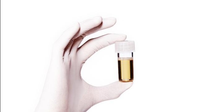 养肝“帮手”被发现,不是菊花,常喝一点,或能给肝洗个澡