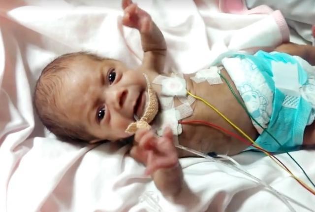 准妈妈|14年过去,原本身体巴掌大“世界最小宝宝”,如今颜值高到认不出