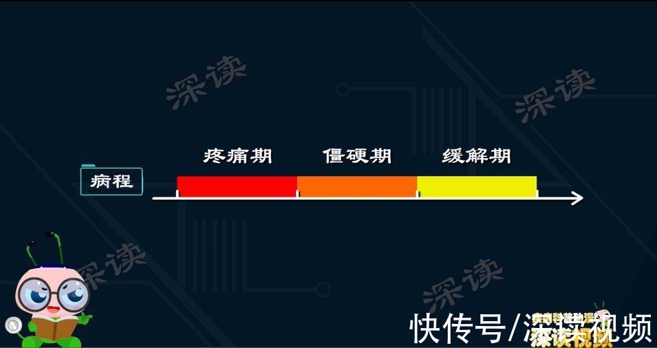 缓解期|熬夜吃鸡肩膀疼，泡妞不敢搂搂抱抱举高高，你是不是有肩周炎啊？