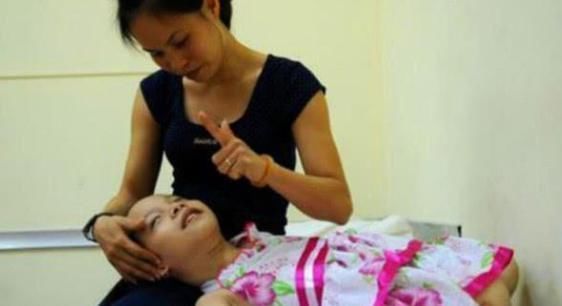 尼克|90后孕妇生下“海豹胎”,曾拒绝医生打掉,如今杂戏团要高价收购