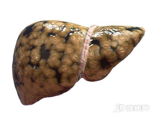 医生|如果你不想得肝癌,请记好这三句话!医生一般都不说