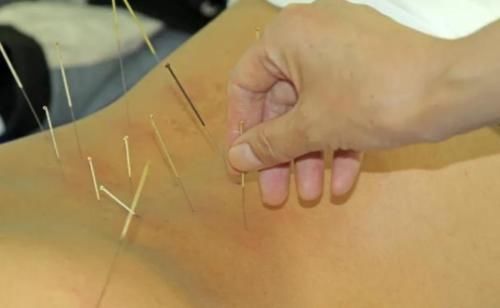 粘膜|中医能治好白血病吗？