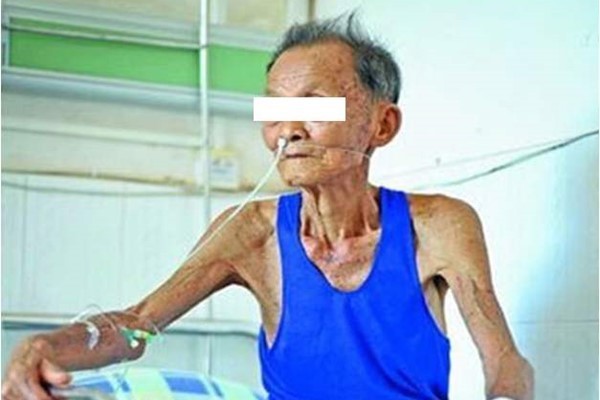 寿命|“老来瘦”不健康,体重预示了寿命!60岁以后,这样的体重才长寿