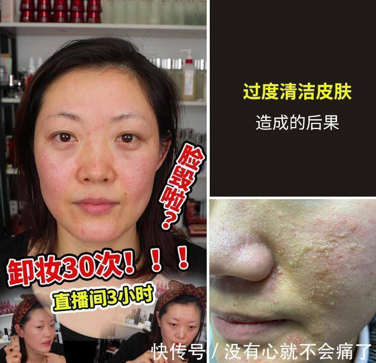 美容院 有没有什么一瓶就可以代替多瓶的只擦一种就可以的护肤品?(精)