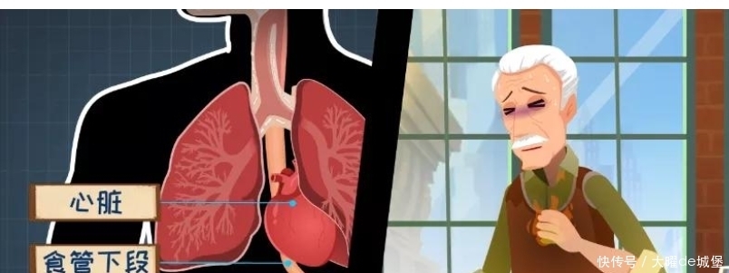 胃食管反流咋回事?反酸烧心背后真相是啥?胃食管反流发病机制