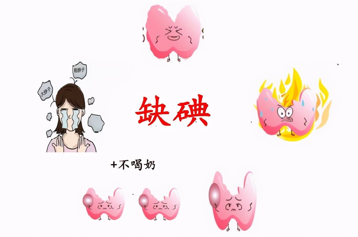 得了甲状腺疾病，补碘还是控碘？海鲜还能吃吗？