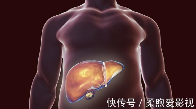 豆类食物|豆浆是肝病的“发物”?医生提醒:若想肝好,3种早餐尽量少碰