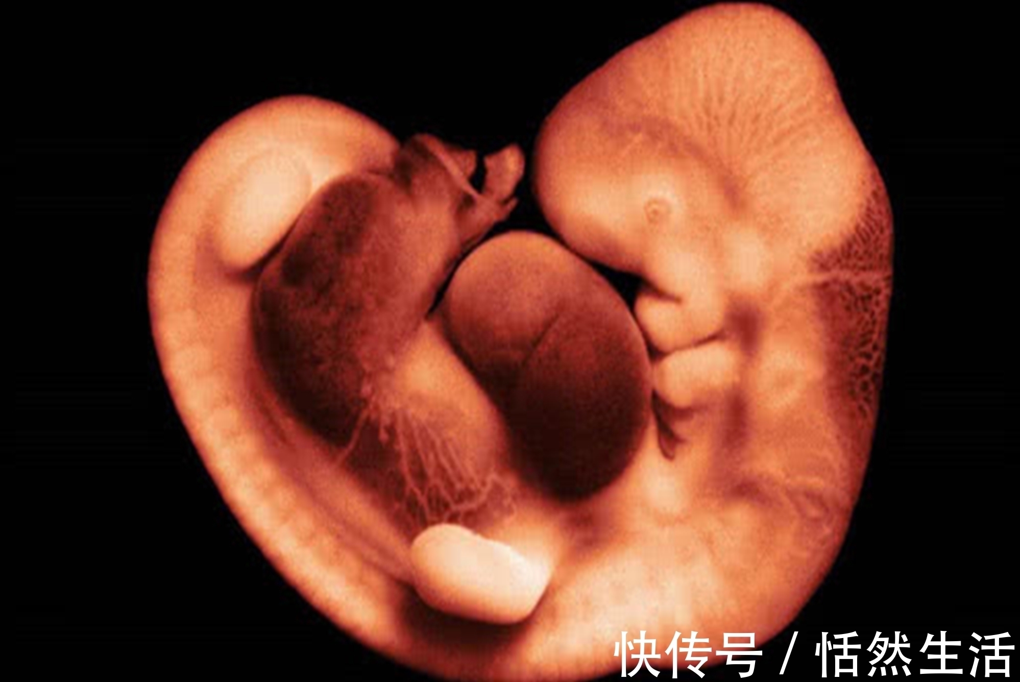 胎儿|孕期B超单上四个指标,暗示胎儿健康信号,达标孕妈可以放心了