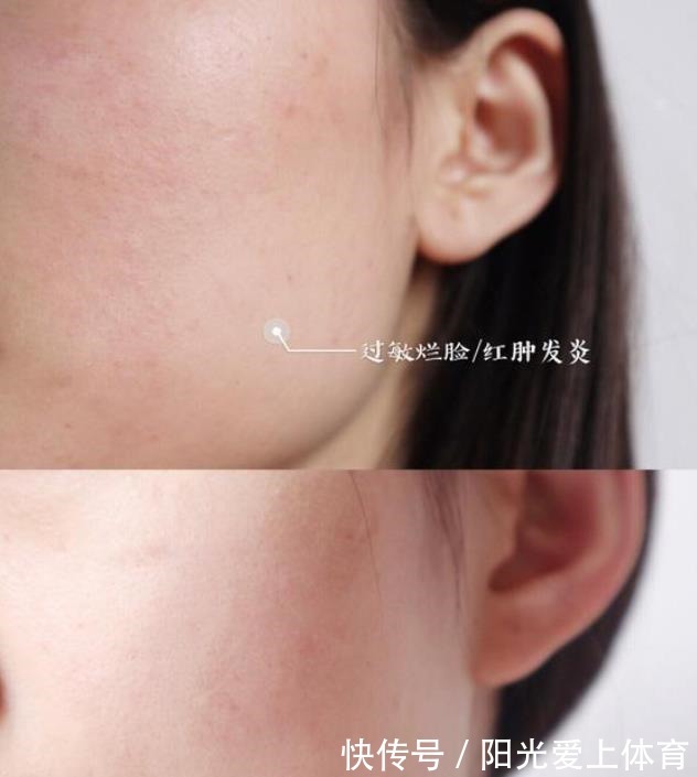 涂面霜 天热还用不用涂面霜总有女人搞错,难怪皮肤一直很差!