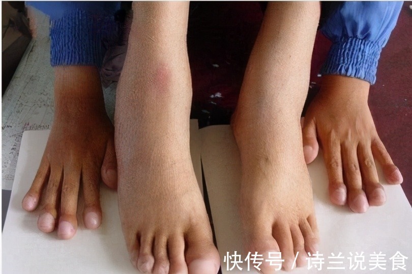 黄麦|脚是身体的“放大镜”,出现3种情况,可能是健康发出“预警”!