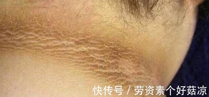 妈妈|6岁小女孩脖颈发黑洗不掉,去医院做检查,医生的话让妈妈笑了