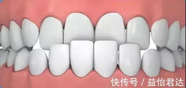 牙齿|孩子12岁前必须处理的牙齿问题!家长都了解吗?