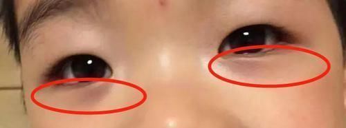 舌苔|3岁女孩一年猛窜28公分,方法是做3事健脾胃,长高又长肉