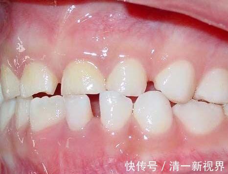 女性|女性开始衰老时,3处会“变大”,2处会“变少”,没有那么恭喜